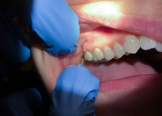 Best Emergency Dental Services for Seniors in Pike Creek Valley, DE